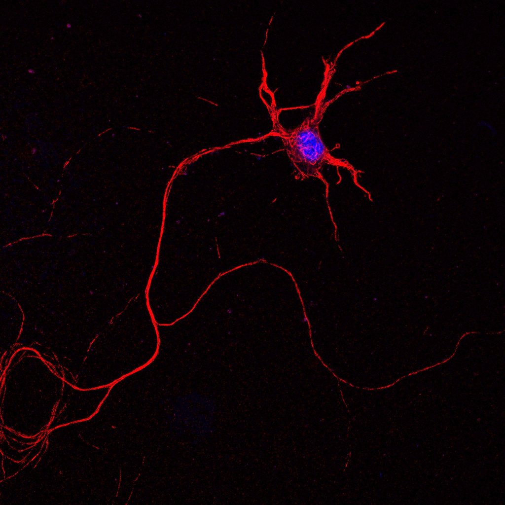 Experimental Peptide Shows Early Promise in Spinal Cord Nerve Repair Trial