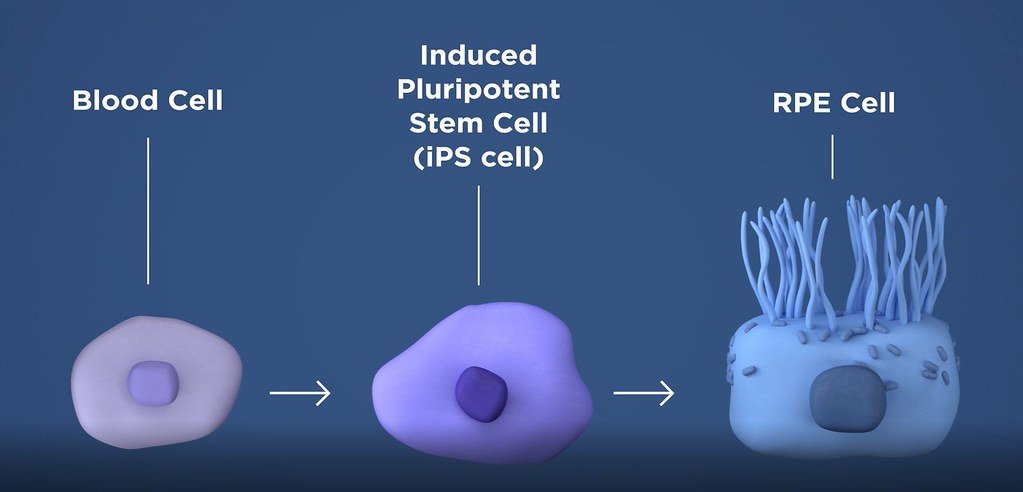 GLP-1 Peptide Therapy Shows Promise in Reducing Heavy Drinking, Trial Finds