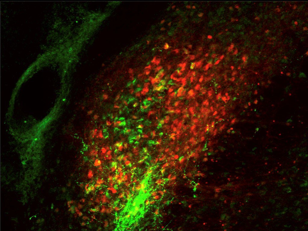Retatrutide: What Emerging Research Suggests About This Promising Investigational Peptide