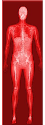New Clinical Trial to Explore How Exercise Can Protect Muscle and Bone During GLP-1 Weight Loss
