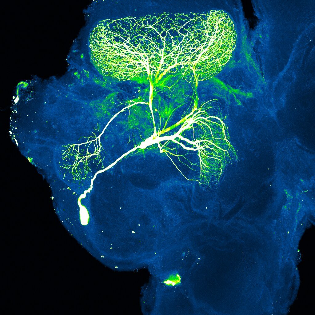 Teitur’s TT-P34 Peptide Shows Promising Early Results for Parkinson’s Disease